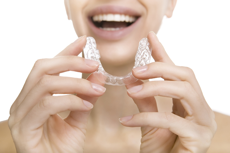 Invisalign