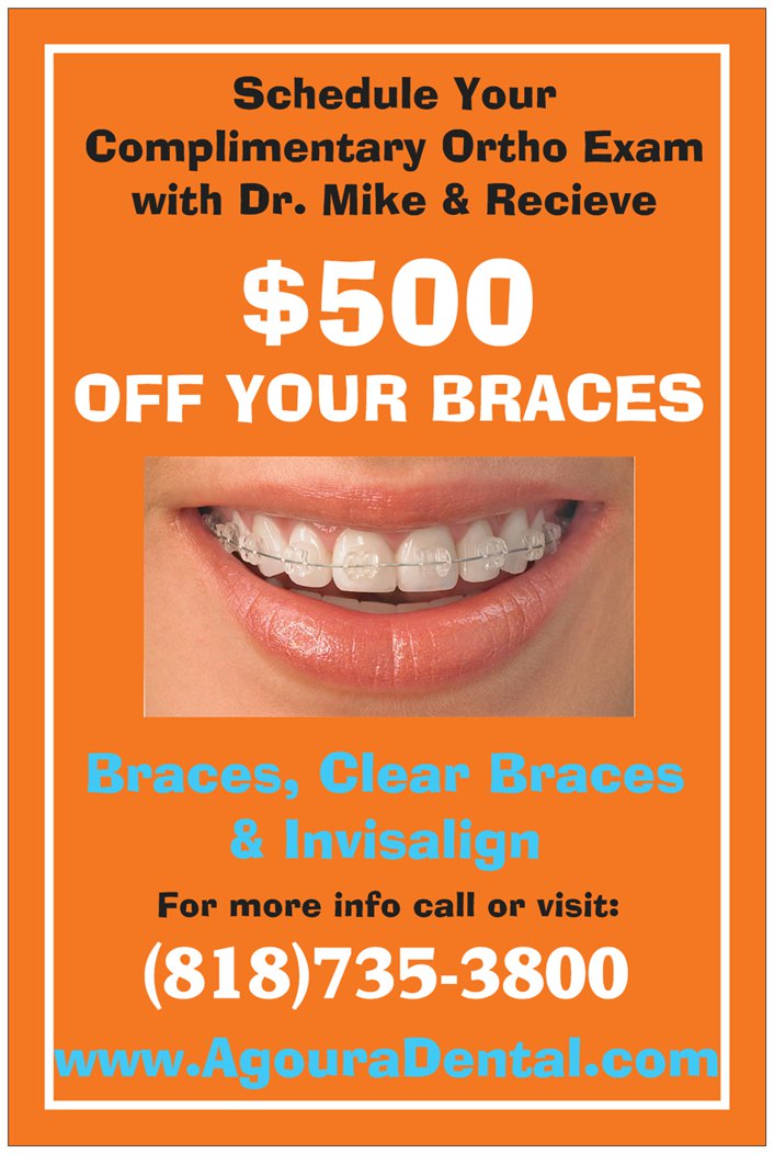 special offer 500 off braces